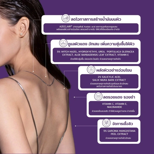 Pharmular Acne Clear Body Spray 30ml фото 3