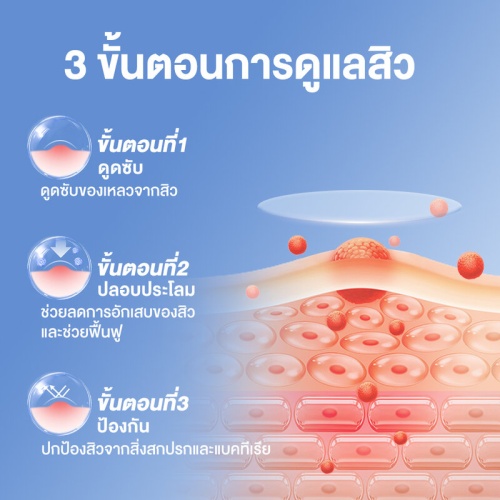 Oni Acne Patch 40 Dots фото 3