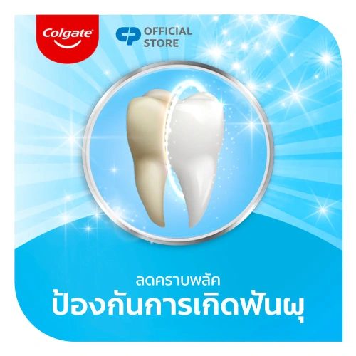 Colgate Advance Whitening Toothpaste 135g фото 3