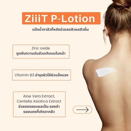 Ziiit P-Lotion 20ml фото 2