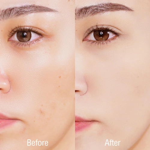 SASI Acne Sol Comfort Powder 4.5g фото 3